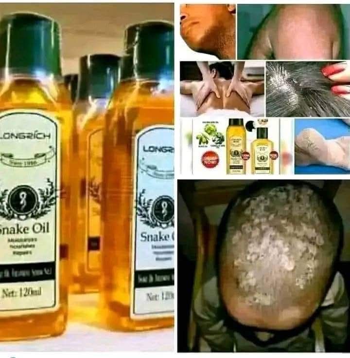 Huile de serpent Longrish